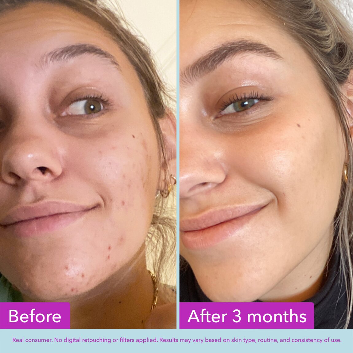 niacinamide-brightening-toner-e2 zb_p.jpg