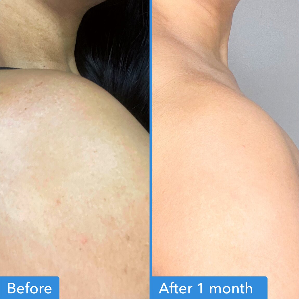discoloration-correcting-body-treatment-b6 zb_p.jpg