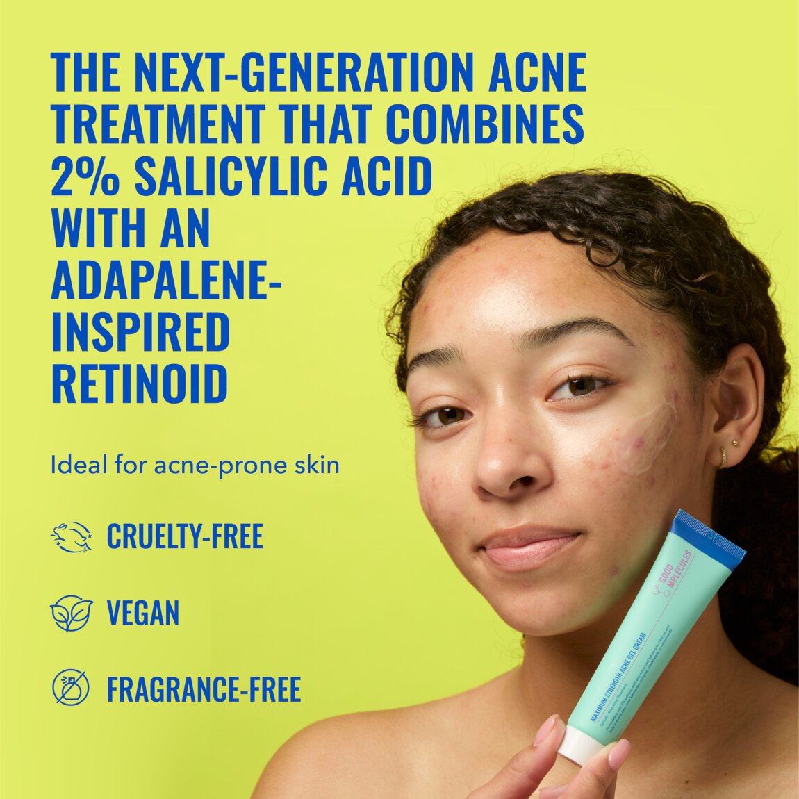 maximum-strength-acne-gel-cream-y4 zb_p.jpg