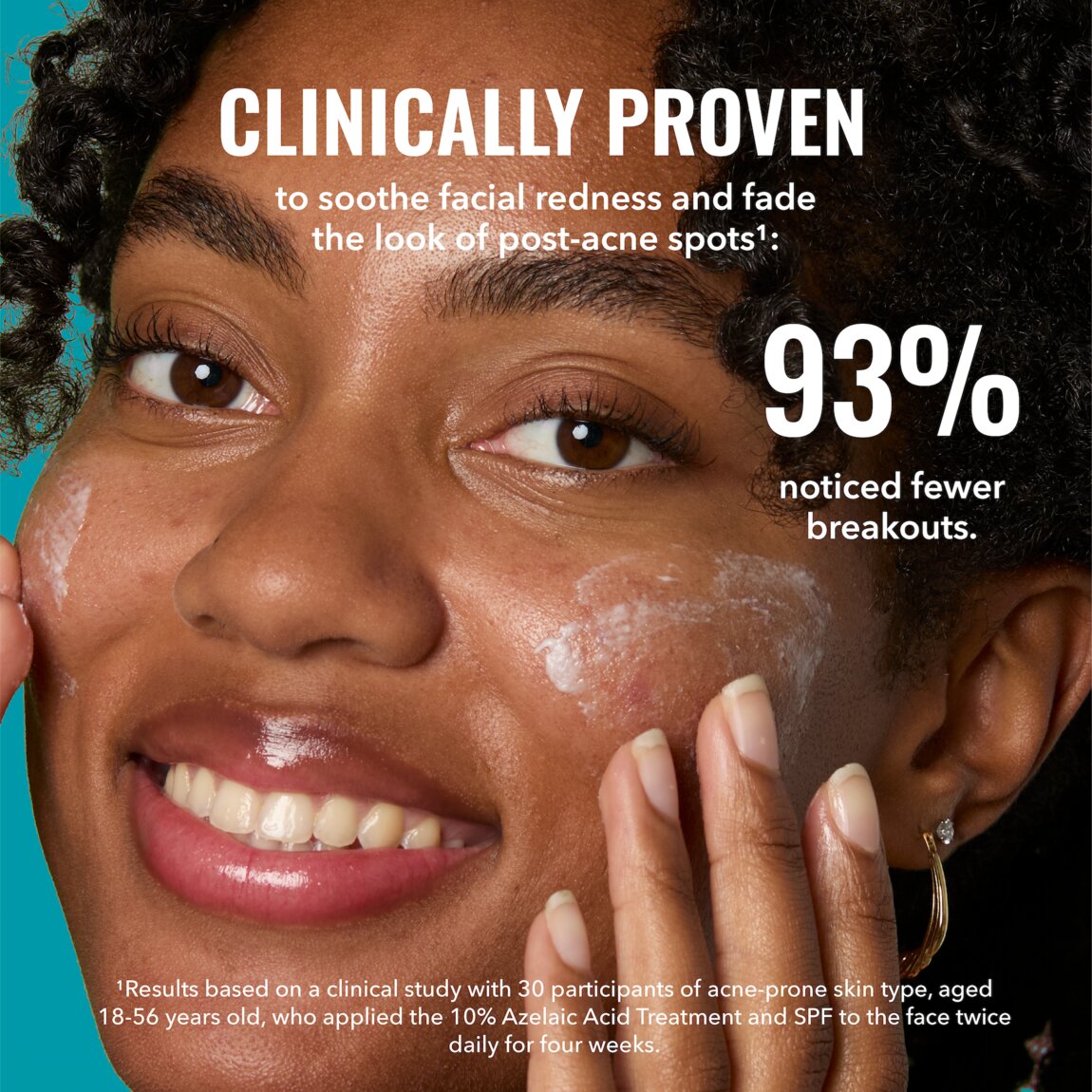 10-azelaic-acid-treatment-f8 zb_p.jpg