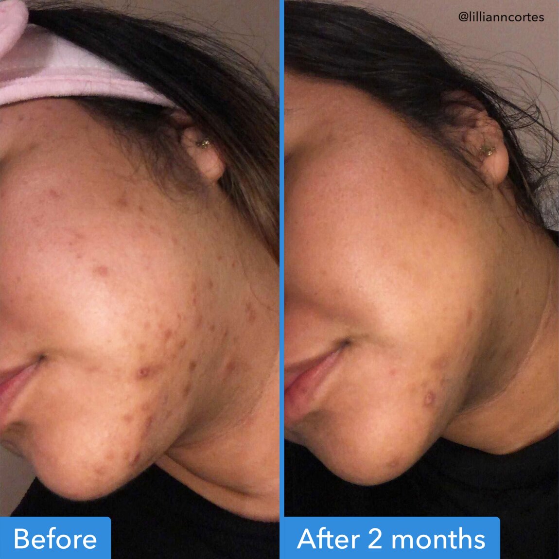 discoloration-correcting-serum-k8 zb_p.jpg